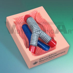 Artery Surgery Model